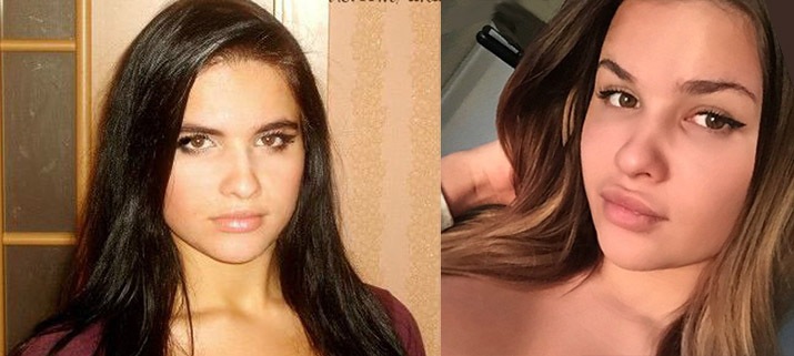 Анастасия Квитко фото до и после пластики